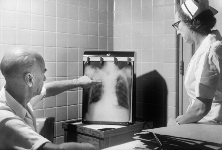 Fundamental and innovative research in Cachexia Tuberculosis